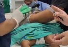 घाटी रुग्णालयातील डॉक्टरांच्या तत्परतेने चिमुकल्याला जीवदान; डॉ. शिवाजी सुक्रे यांच्या मार्गदर्शनाखाली यशस्वी शस्त्रक्रिया