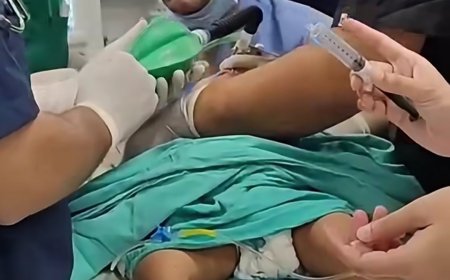 घाटी रुग्णालयातील डॉक्टरांच्या तत्परतेने चिमुकल्याला जीवदान; डॉ. शिवाजी सुक्रे यांच्या मार्गदर्शनाखाली यशस्वी शस्त्रक्रिया